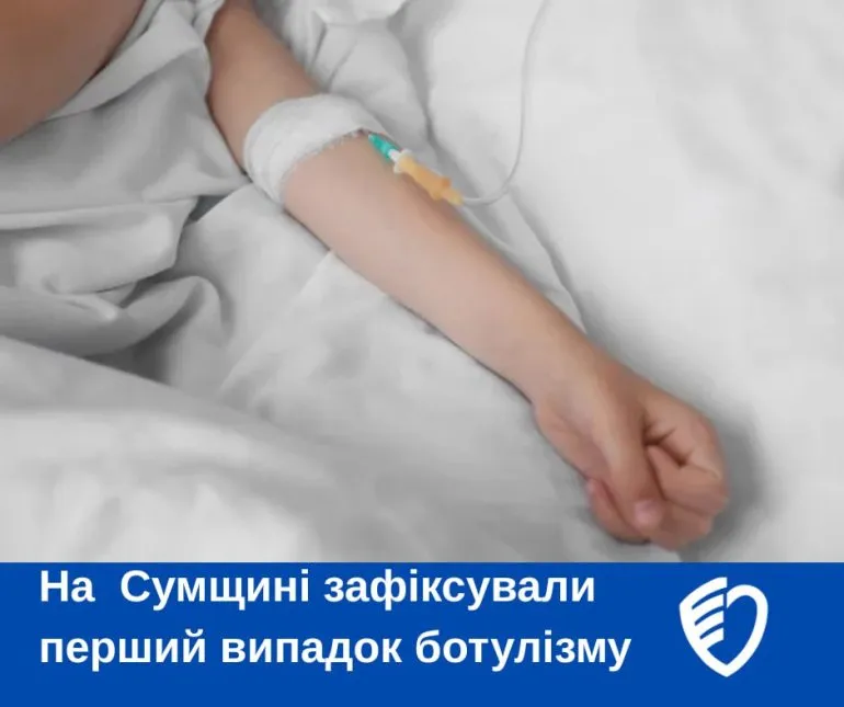 У Сумах зафіксували перший цього року випадок ботулізму